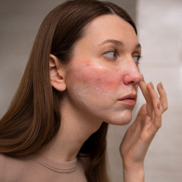 Acne & Inflammation