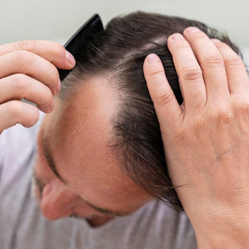 Hair Loss