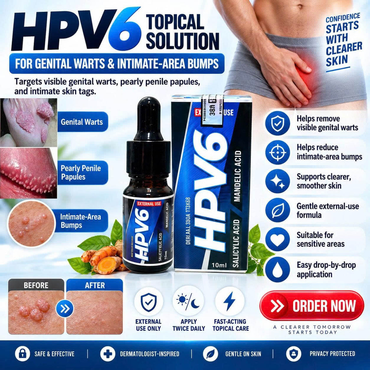 HPV6 Serum — A Topical Serum For Application To Genital-Area Lesions. It Is Designed To Help Remove Genital Warts, Pearly Penile Papules, Genital Bumps, And Other Unusual-Looking Spots That Appear In The Intimate Area.