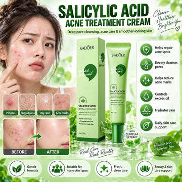 Salicylic Acid Acne Treatment Face Cream